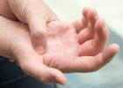 تنميل اليد اليمنى.. 8 أسباب تجعلك تذهب للطبيب فورًا