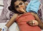 الطفلة ريفان جنينة