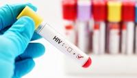 احدى الفحوصات لمرض الإيدز
