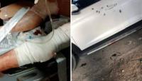 جانب من محاولة اغتيال الدكتور ناصر الدين الشاعر