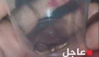 الرصاصة التي قتلت بها شيرين أبو عاقلة