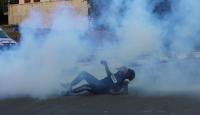 صحفي فلسطيني القى عليه جيش الاحتلال قنبلة غاز