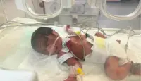 التشوهات الخلقية