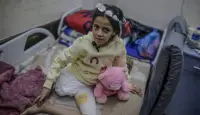 طفلة مصابة في احدى المستشفيات