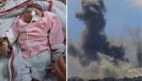 اطفلة بلا دماغلطفلة ملك أحمد القانوع