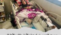 سيدة فقدت ساقها في الحرب