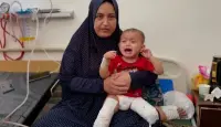 طفلة عمرها سنتان من غزة، بترت ساقها بعد أن علقت تحت الأنقاض جراء القصف