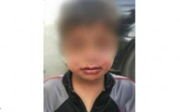 ابوه كسر فكه لكثرة بكائه