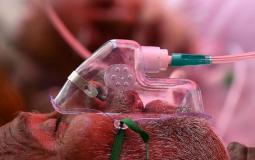 الفطر الاسود