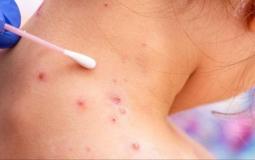 صورة توضيحية
