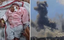 اطفلة بلا دماغلطفلة ملك أحمد القانوع