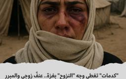 عنفٌ زوجي والمبرر جاهز: "ضغط الحرب"!