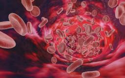 كوفيد طويل الأمد