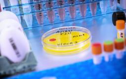 إنفلونزا الطيور