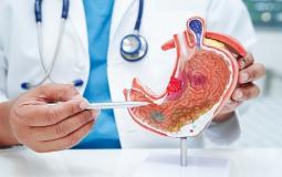 قرحة المعدة