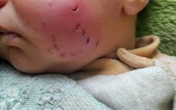 الرضيع آدم الأستاذ