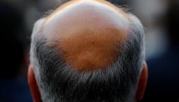 صورة توضيحية
