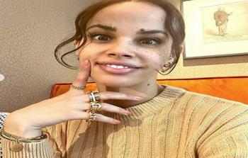 في مفاجأة لها.. خطيب نور عمرو دياب يعرض عليها خاتم الزواج راكعا على ركبته