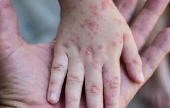 صورة توضيحية