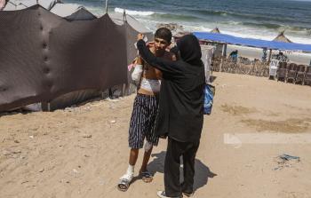 فتى فلسطيني فقد ذراعيه جراء القصف الإسرائيلي