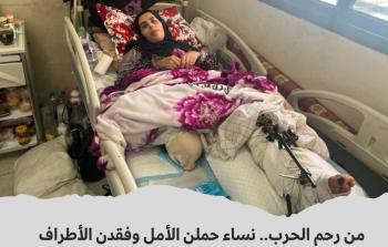 سيدة فقدت ساقها في الحرب