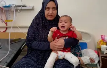 طفلة عمرها سنتان من غزة، بترت ساقها بعد أن علقت تحت الأنقاض جراء القصف