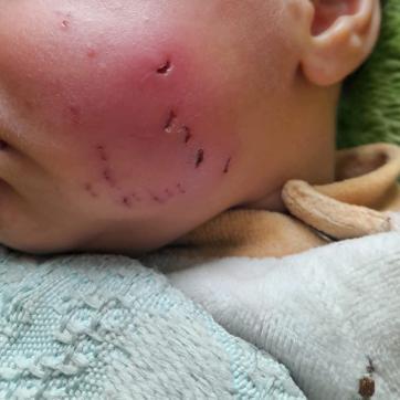 الرضيع آدم الأستاذ