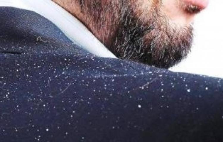 قشرة الشعر