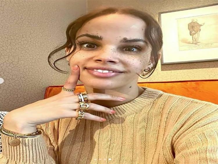 في مفاجأة لها.. خطيب نور عمرو دياب يعرض عليها خاتم الزواج راكعا على ركبته