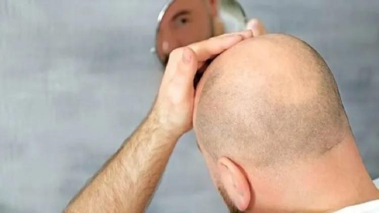صورة توضيحية