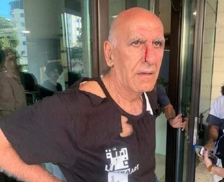 المخرج ادوارد المعلم بعد الاعتداء عليه