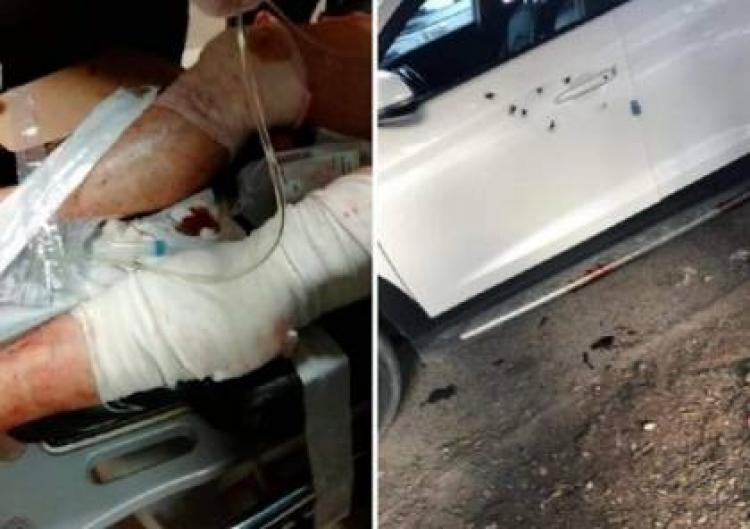 جانب من محاولة اغتيال الدكتور ناصر الدين الشاعر