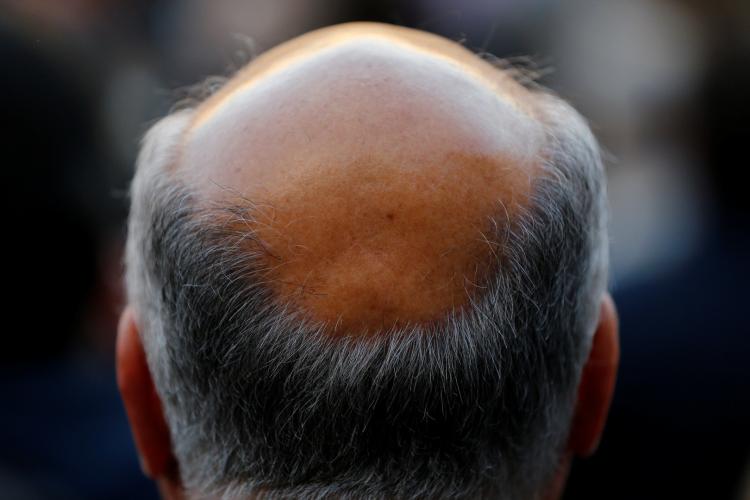 صورة توضيحية