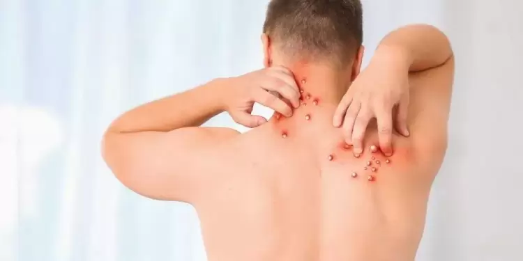 صورة توضيحية