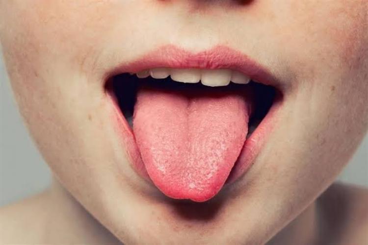 صورة توضيحية