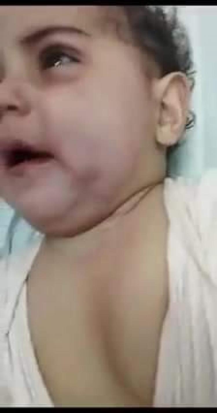 الطفلة المعتدى عليها