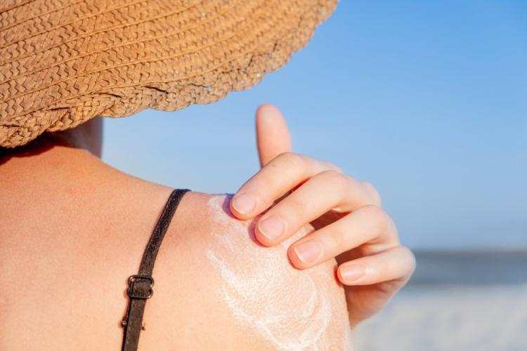 أعراض تسمم الشمس