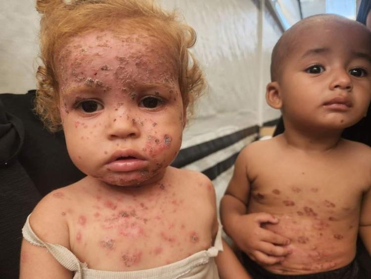 اطفال غزة خلال الحرب على القطاع