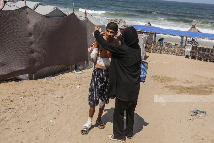 فتى فلسطيني فقد ذراعيه جراء القصف الإسرائيلي