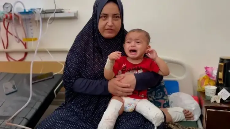 طفلة عمرها سنتان من غزة، بترت ساقها بعد أن علقت تحت الأنقاض جراء القصف