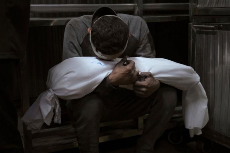 أب يحتضن طفله الشهيد