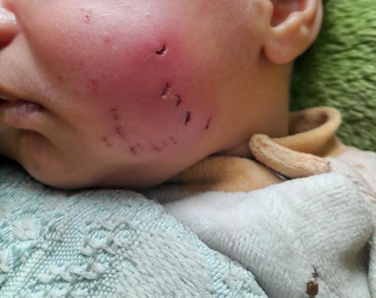 الرضيع آدم الأستاذ