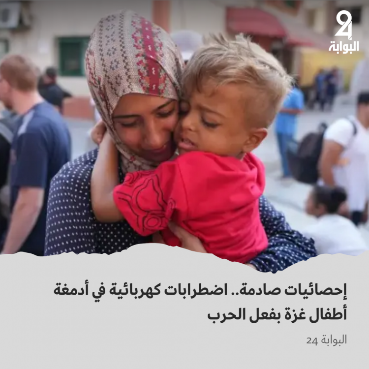 طفل مريض يتشبث بأمه قبل مغادرته غزة مع جدته - أسوشييتد برس