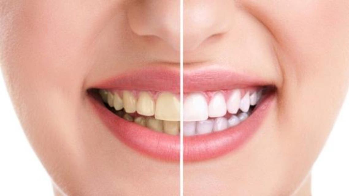 طرق طبيعية متنوعة لتبييض الأسنان