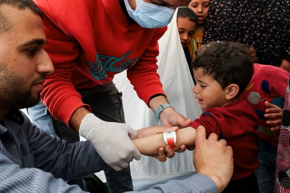أطباء يفحصون أحد الأطفال في مخيمات النزوح